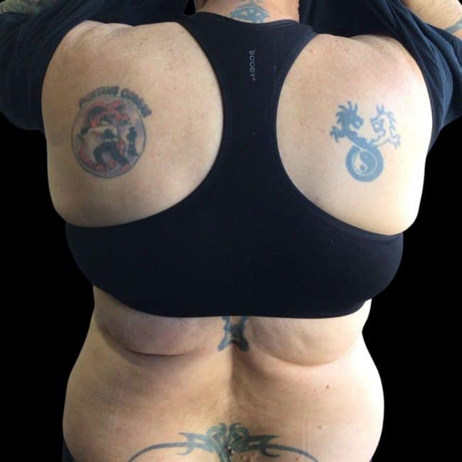 CB Ink Tattoo Pre Cover Up Back Tattoo 2