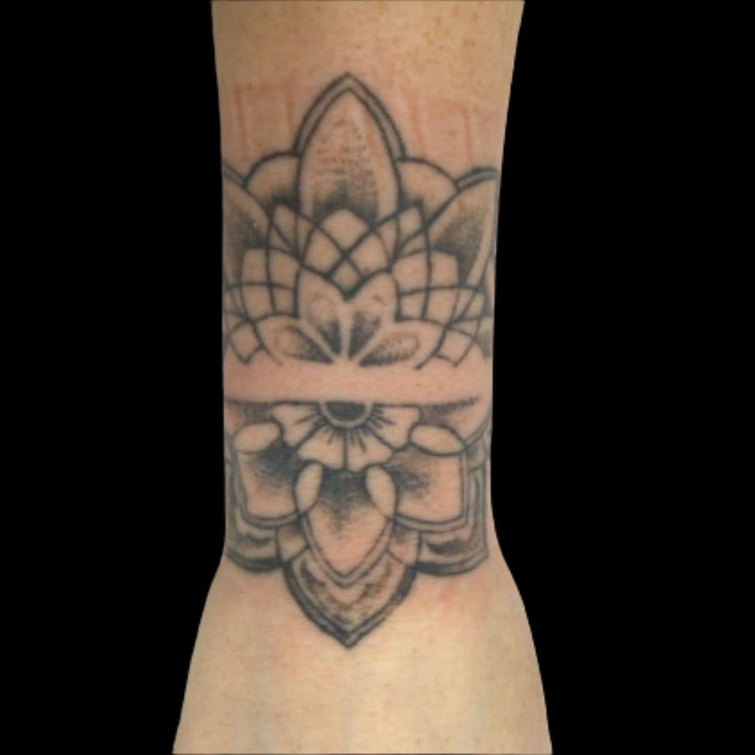 Laser Tattoo Treatment Before Brooke