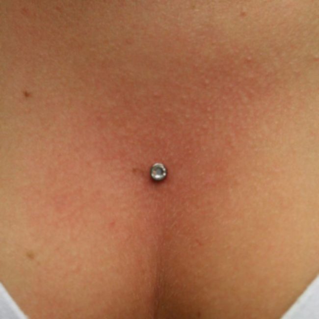Dermal Piercing Brisbane Tattoo Studio 2